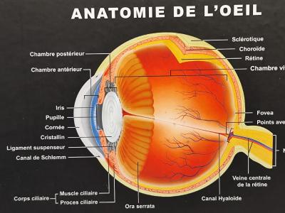 La Cataracte: qu'est-ce que la cataracte de l'oeil ? Votre opticien sur Nice vous explique.
